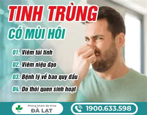 Hình ảnh minh họa